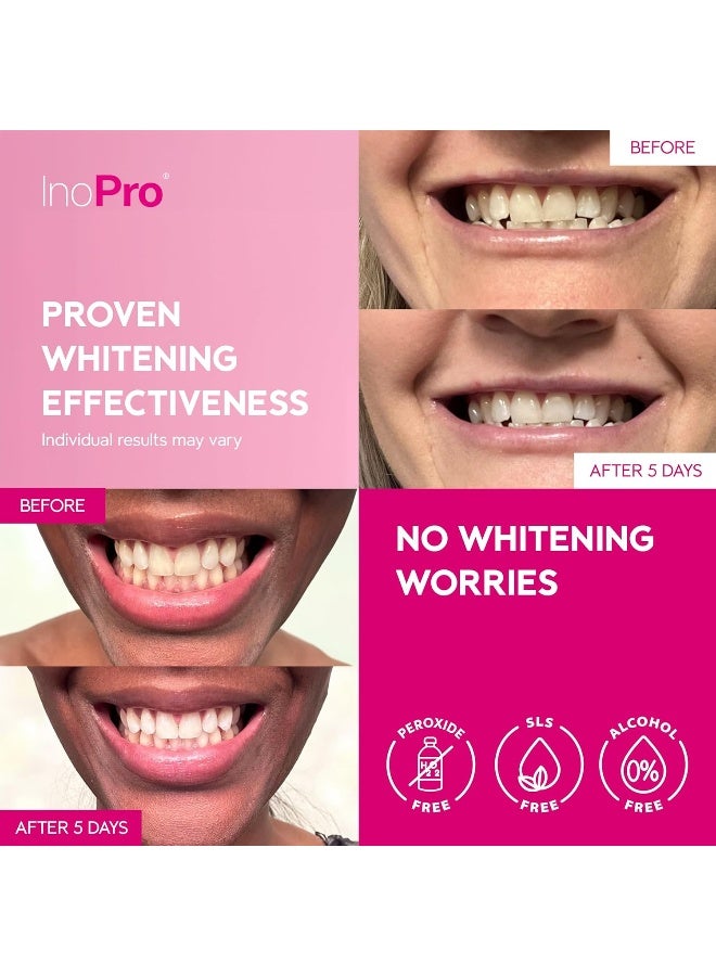 InoPro Teeth Whitening Strips 14 Treatments - Peroxide Free - Whitening Without The Harm - Deep Stains Removal - Whitening for Sensitive Teeth - 28 Strips - Image 2